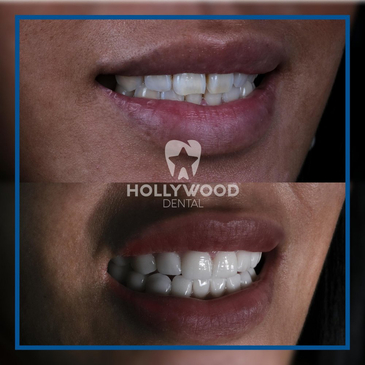 Slider image (5) Hollywood Dental Izmir Turkey